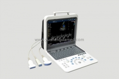 Ysd900 3D 4D Digital Portable Color Doppler Ultrasound CE ISO SGS Approved