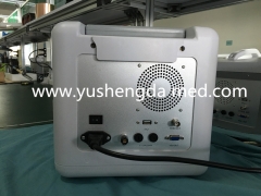Medical Portable Digital Ultrasound Scanner