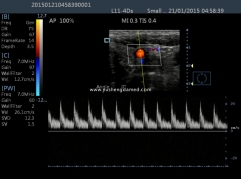 YSD900A 4D Color Doppler Diagnostic Handheld Ultrasound Scanner