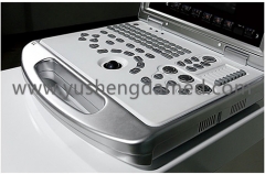 Digital Laptop Color Doppler Ultrasound Machine