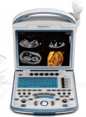 YSD4600 Medical Device Full Digital  System Ultrasound Scanner