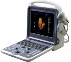 YSD900A 4D Color Doppler Diagnostic Handheld Ultrasound Scanner