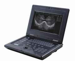 Digital Laptop Ultrasound Scanner YSD4000B