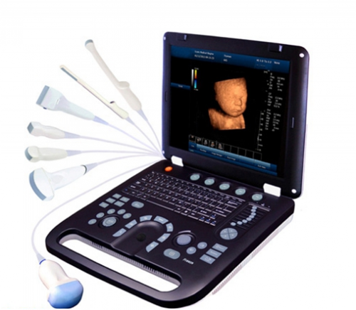 Full Digital Veterinary Ultrasounds Machine YSD4100A-Vet