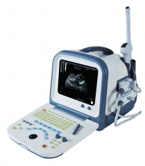 Hot sale ultrasound scanner YSD1308A