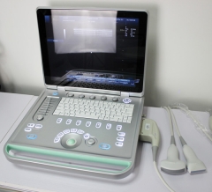 YSD518 Color Doppler Ultrasound Scanner