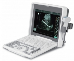 YSD1300C Portable Ultrasound System