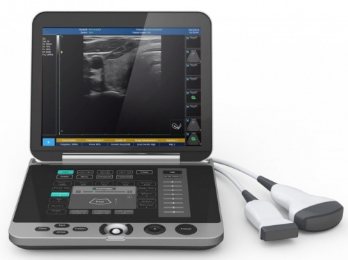 YSD4100B Lap-top Ultrasound System