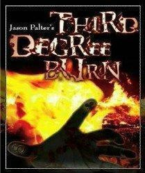 Jason Palter - Third Degree Burn