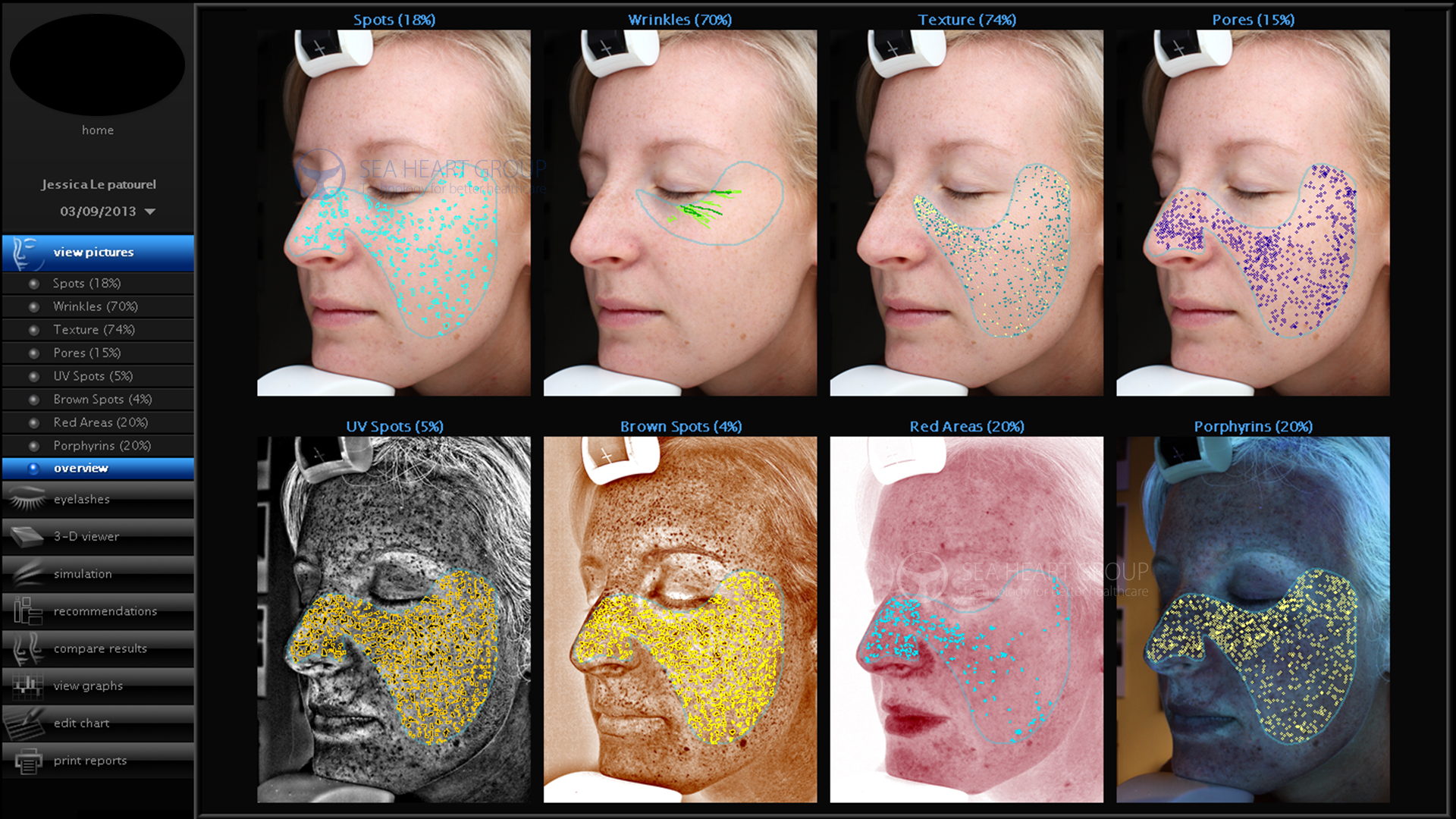 Анализ кожи по фото онлайн
