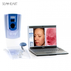 Facial Imaging System | Reveal Imager Skin Analysis System for Clinical Research