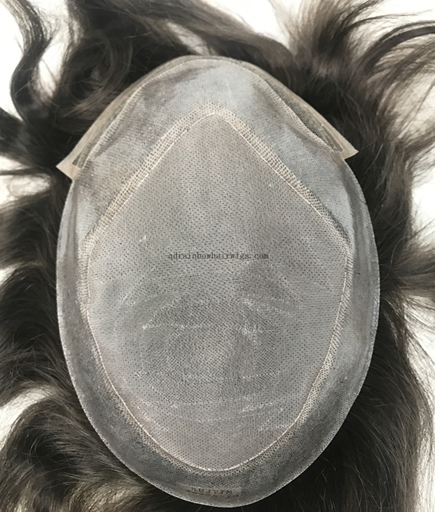 Non Surgical European Hair Replacement for Hair Loss