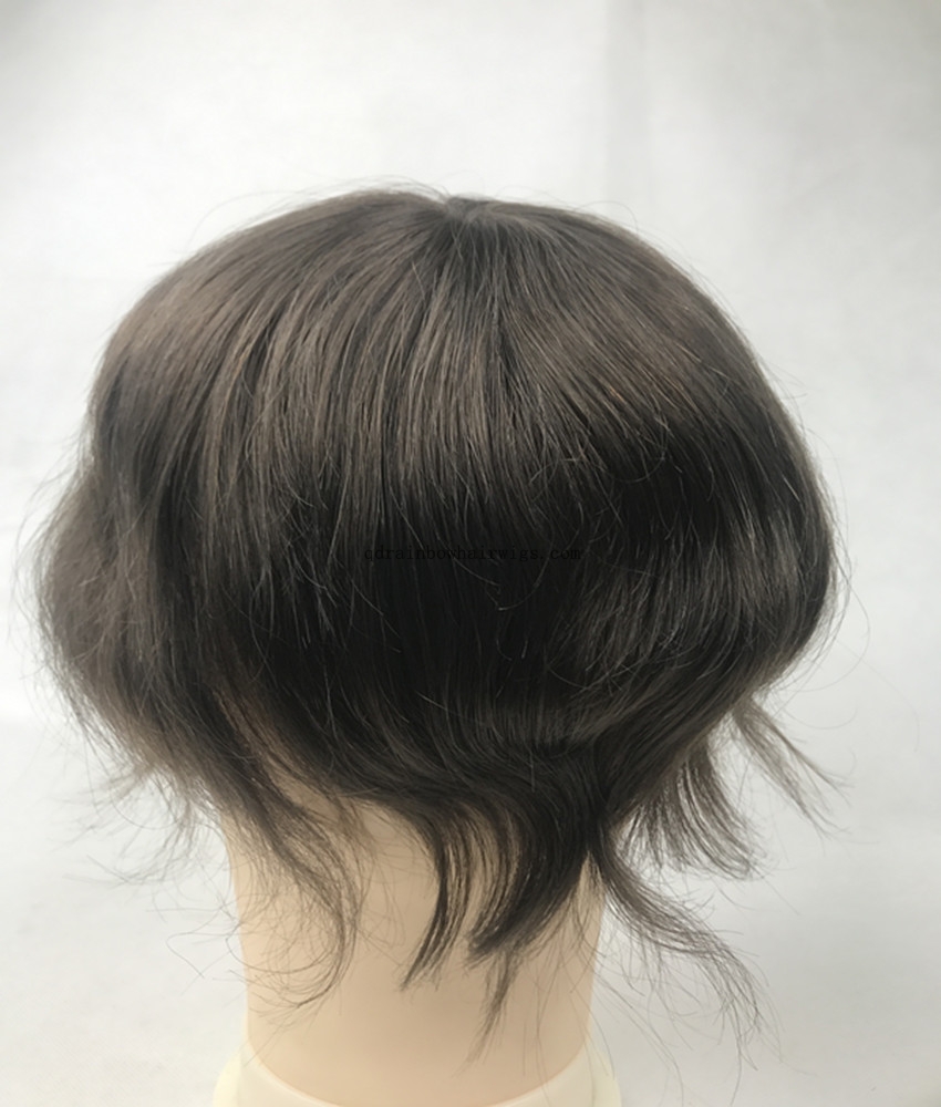 Non Surgical European Hair Replacement for Hair Loss