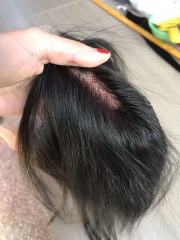4x4 5x5 6x6 human hair lace closures