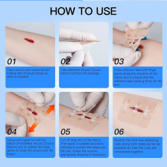 Emergency Wound Closures Device