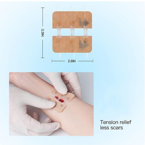 Emergency Wound Closures Device