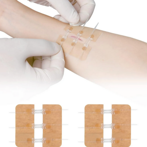 Emergency Wound Closures Device