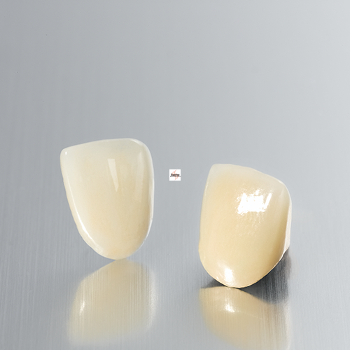 porcelain fuse to metal crown