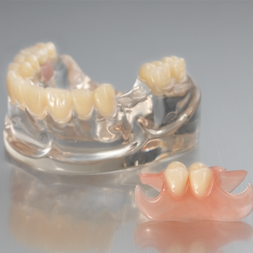 removable-one side flexible denture