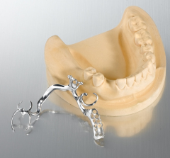 removable-lower cast partial