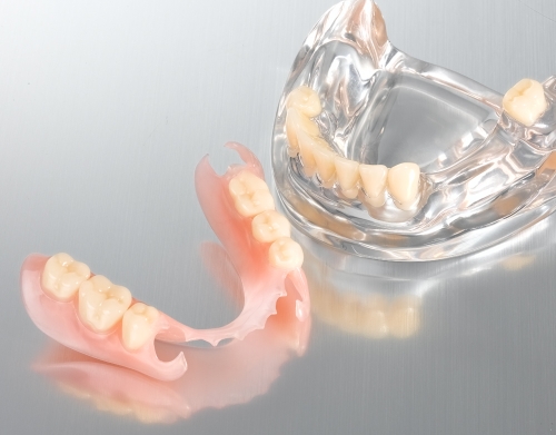 removable-lower flexible denture
