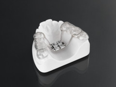 rapid palatal expansion with occlusal splint