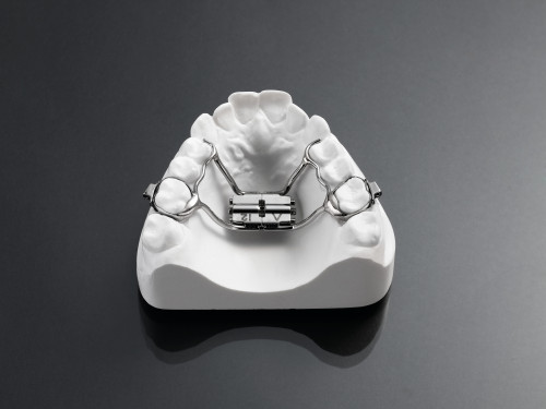 rapid palatal expansion with hooks
