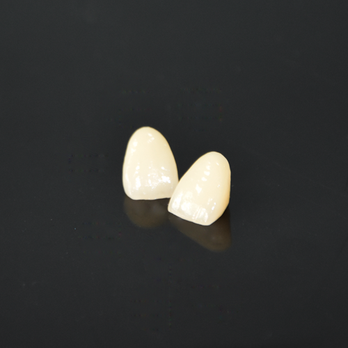 CAD-CAM zirconia fused to porcelain crown