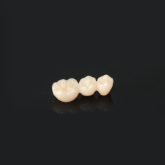CAD-CAM zirconia full contour bridge