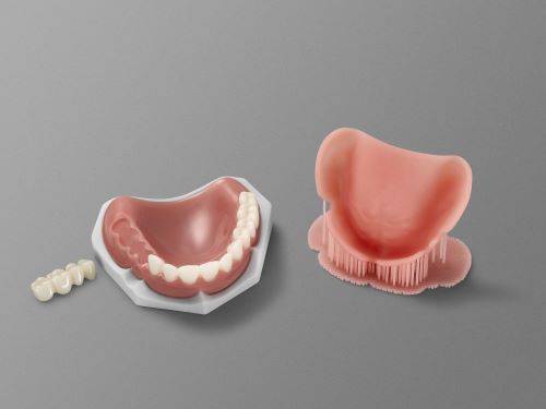 Digital Acrylic Denture