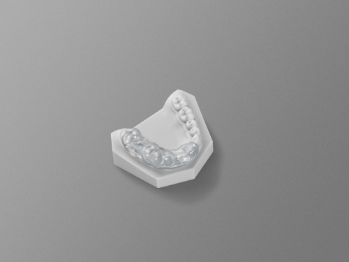 Surgical Guide Tooth Supported