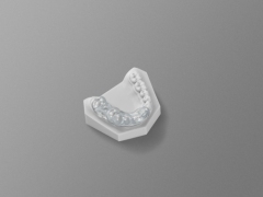 Surgical Guide Tooth Supported