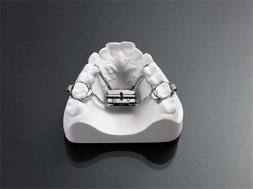 Rapid Palatal Expansion(Upper)