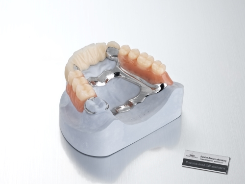 PFM& Co.Cr with Ball Attachment