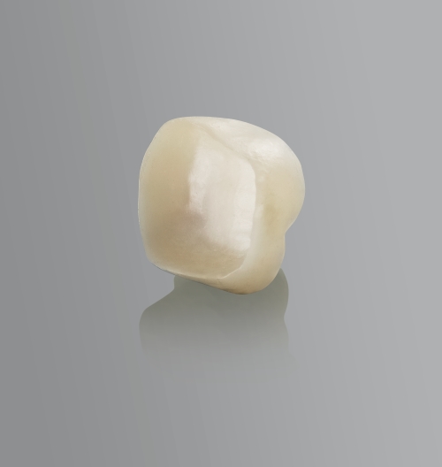 Zirconia Abutment & Custom Abutment with Zirconia Screw Retained Crown