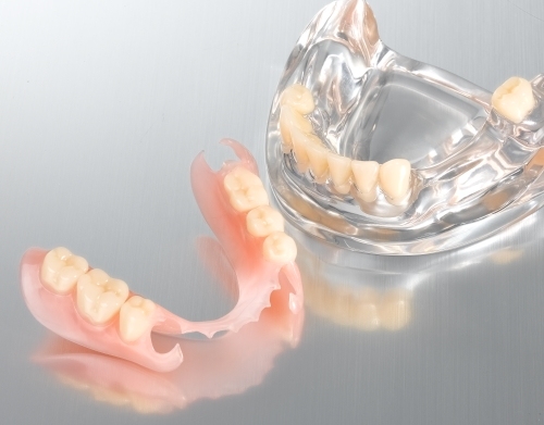 Flexible/Valplast Denture