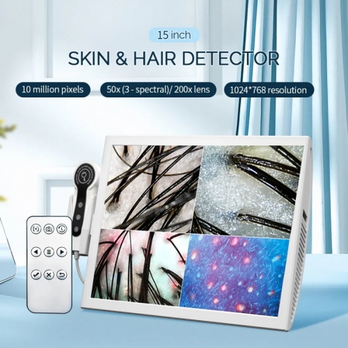 Oil Moisture Skin Analyzer with 15 Inch HD Display 50/200x Scalp Hair Follicle diagnostic device