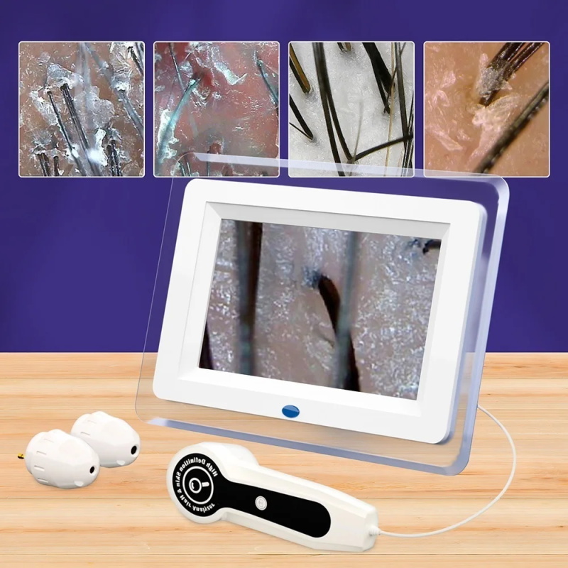 skin magnifier professional skin analyzer