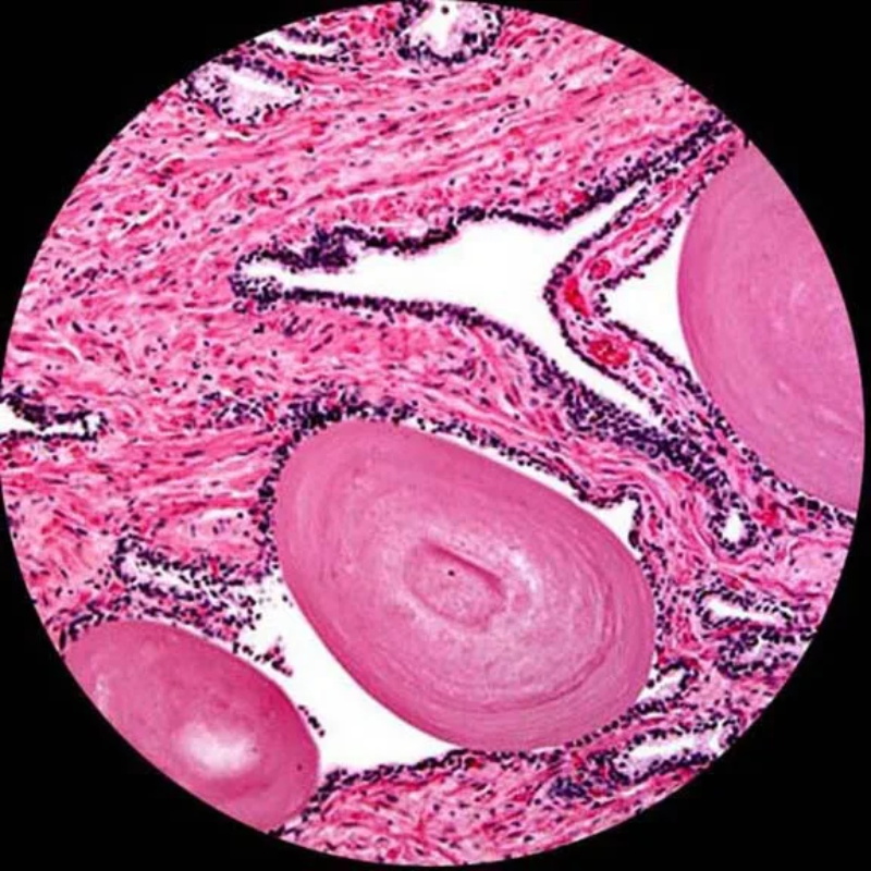 Binocular compound microscope