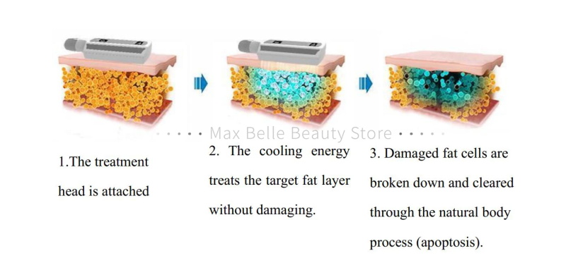 body slimming shape muscle shape machine