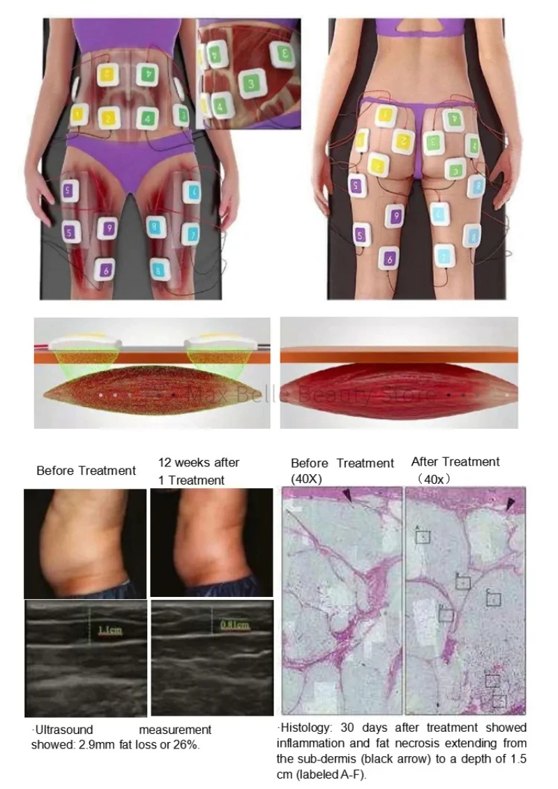 Machine de forme musculaire amincissante pour le corps