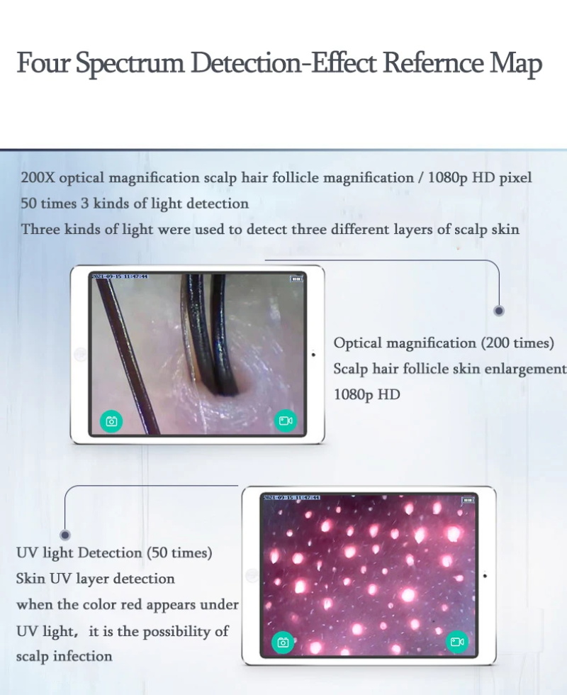 Hair follicle detector