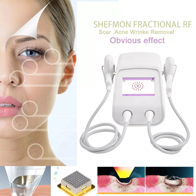 pigment scar wrinkle stretch removal machine