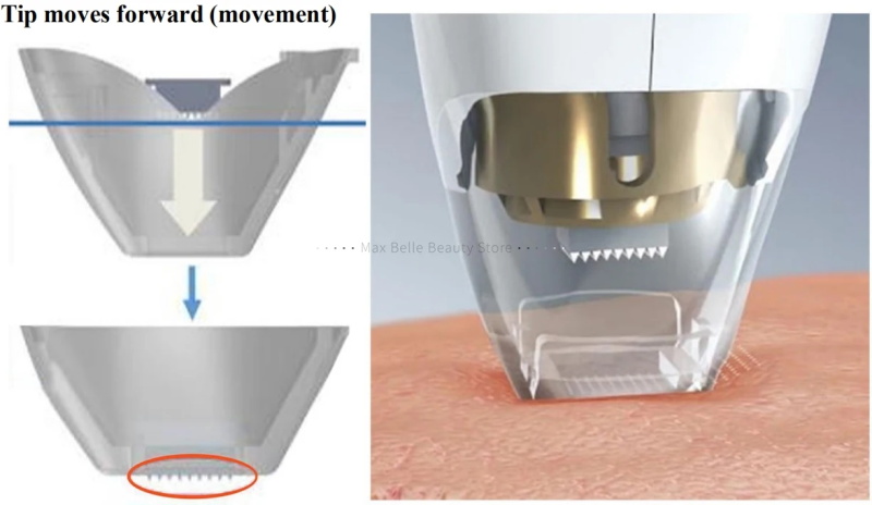 pigment scar wrinkle stretch removal machine