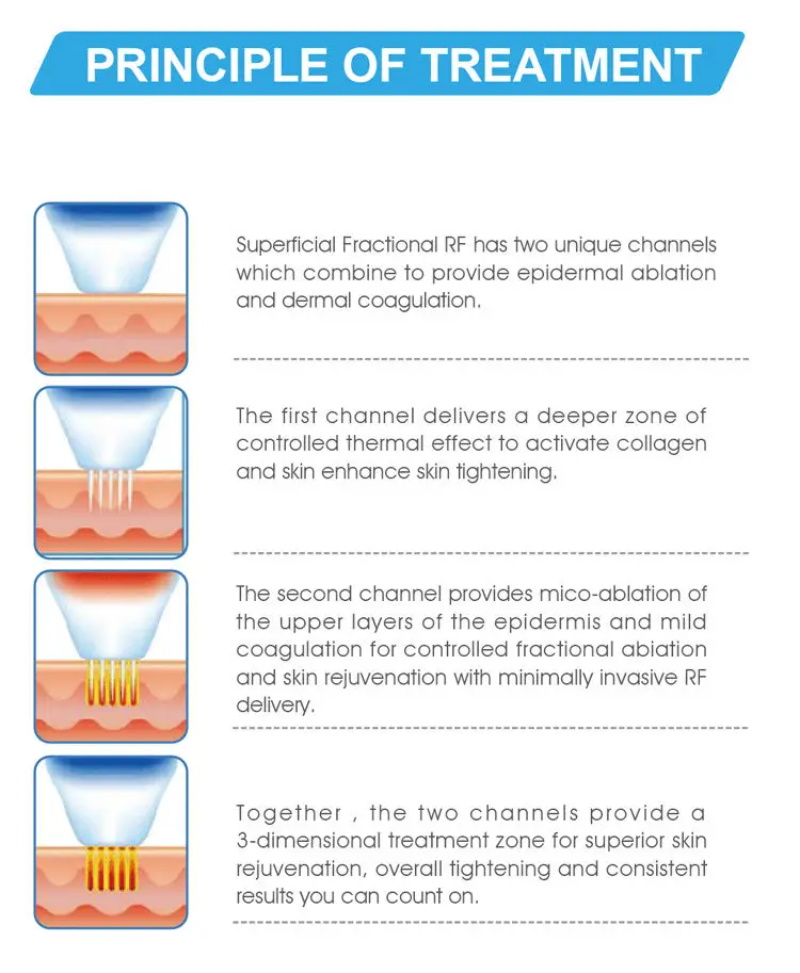 RF fractional microneedle machine