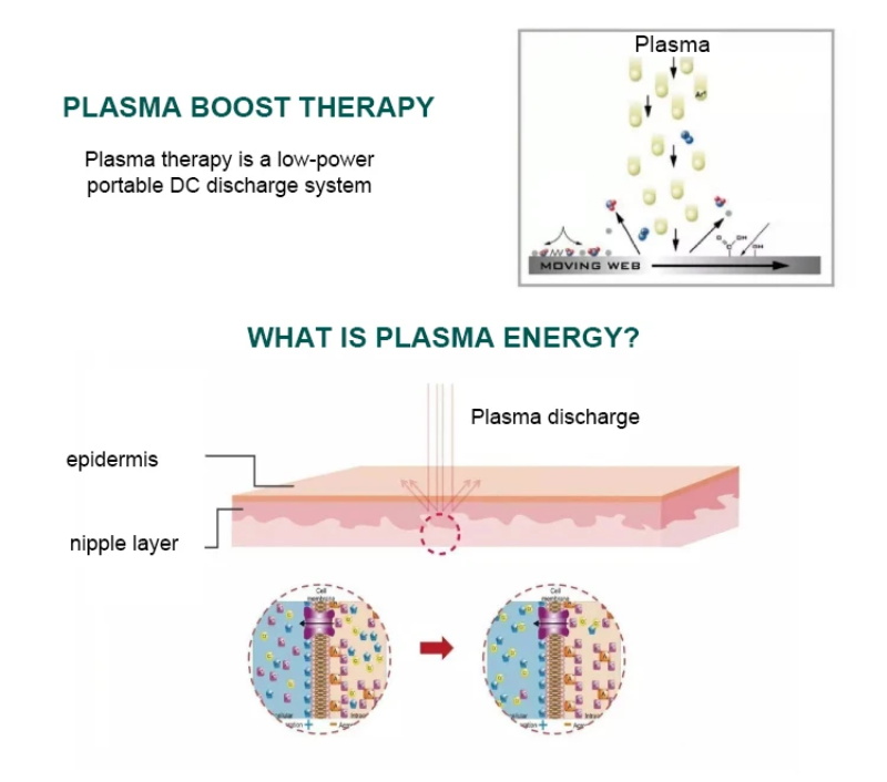 Machine à plasma d'ozone