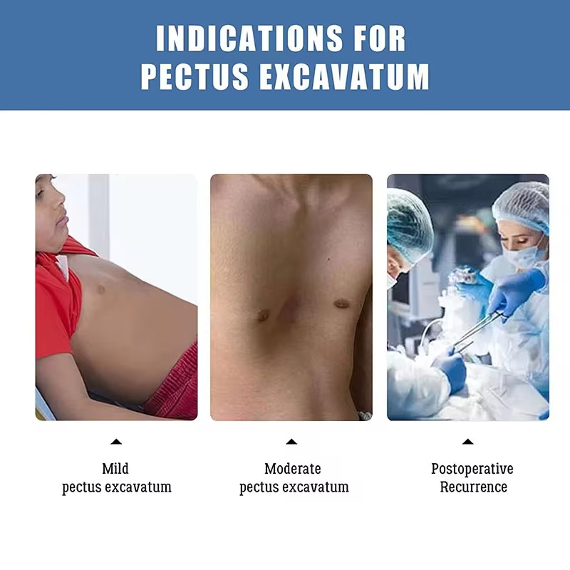 Pectus excavatum orthopedic brace