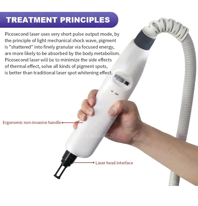 Nd YAG Laser Tattoo Removal Machine