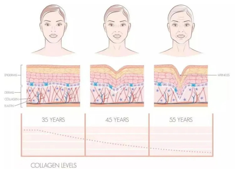 RF Microneedling Machine