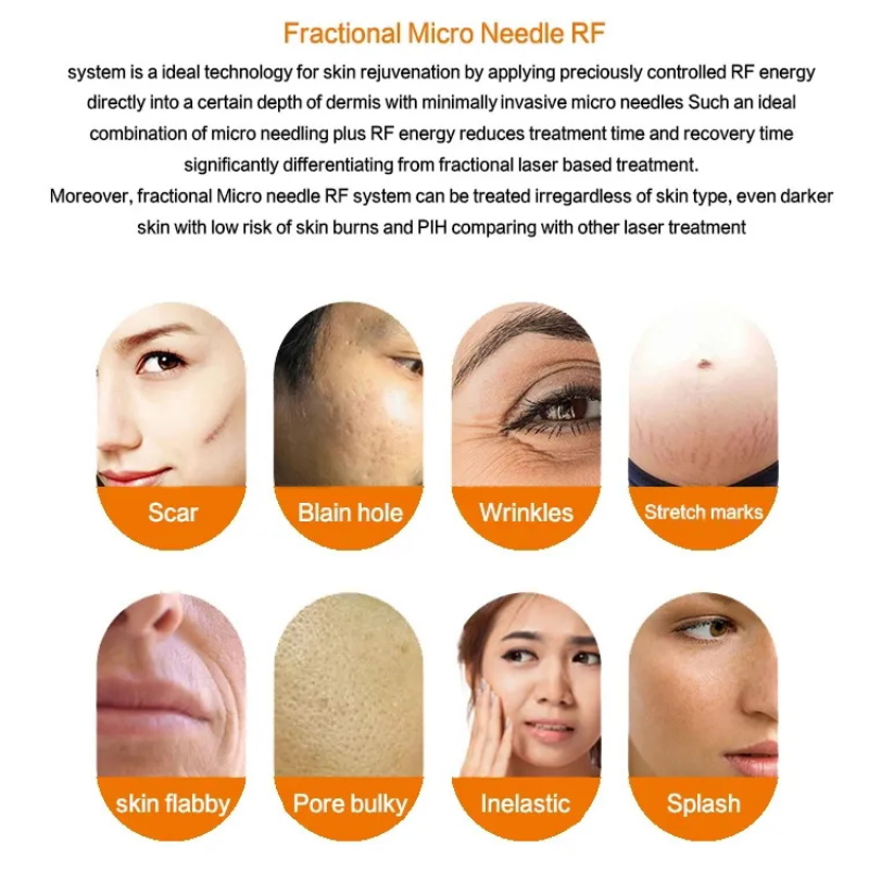 RF Microneedling Machine